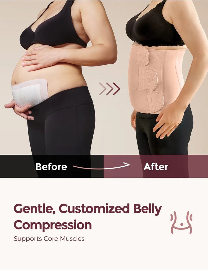 Before and after comparison showing support from the Momcozy Ergowrap Postpartum Belly Wrap after pregnancy.
